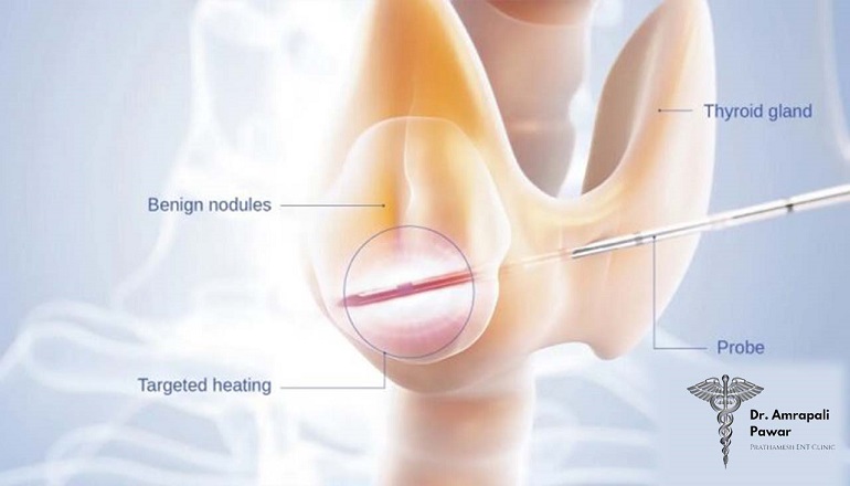 Best ENT Surgeon in Mumbai