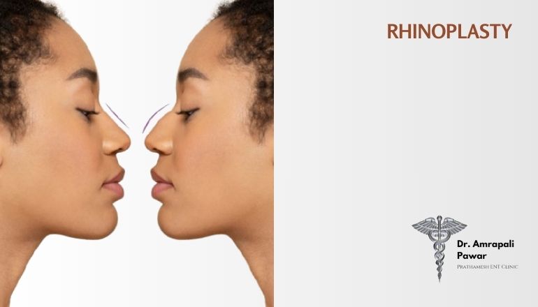 Rhinoplasty in Mumbai